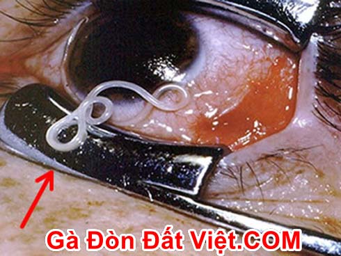 Gà chọi sán ở mắt không nên nuôi.